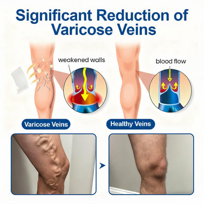 🥰🥰IE👨‍⚕️✅ Natravor® VeinEase Microneedle Care Patch ⚡ Fast Comfort, Lasting Leg Support