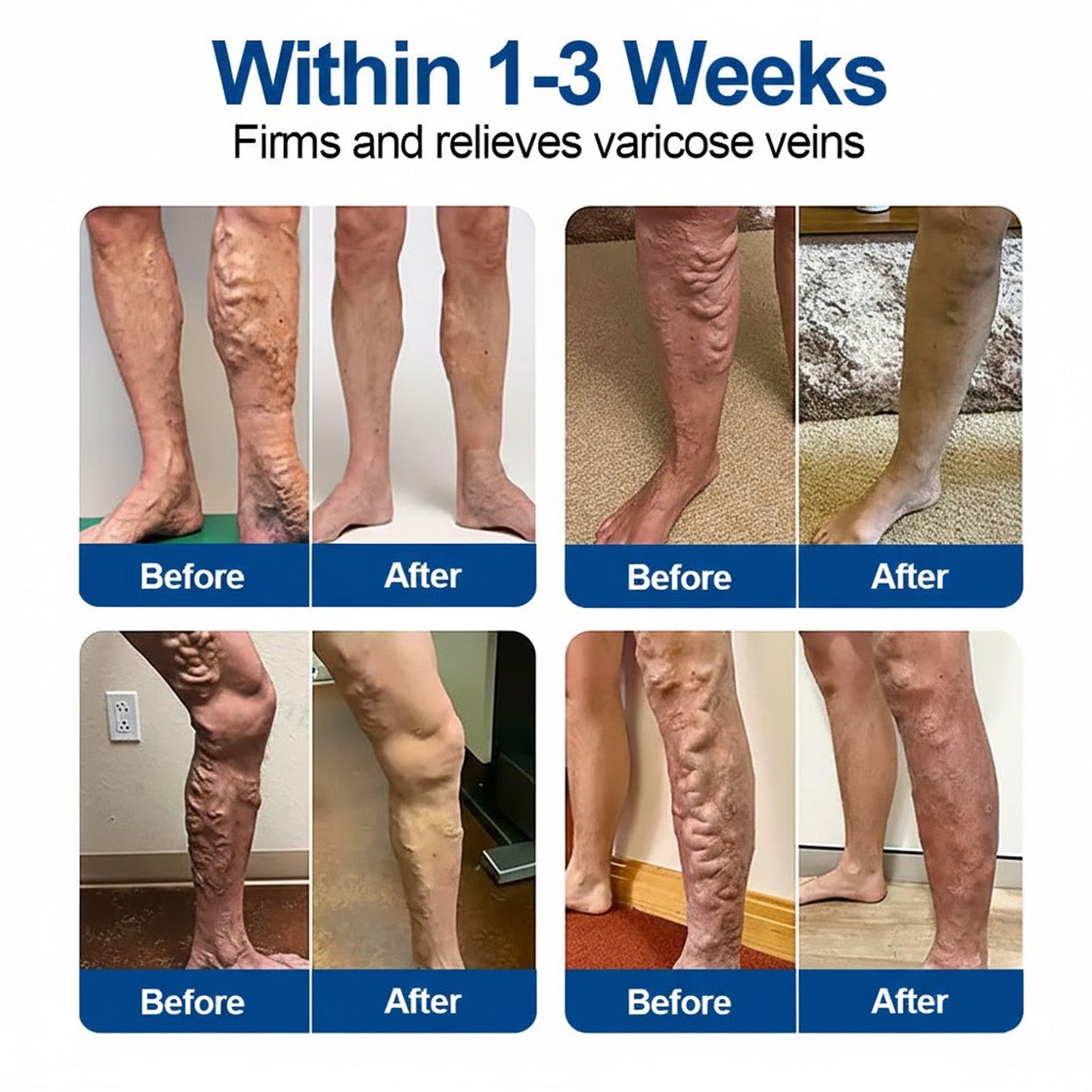 🥰🥰IE👨‍⚕️✅ Natravor® VeinEase Microneedle Care Patch ⚡ Fast Comfort, Lasting Leg Support