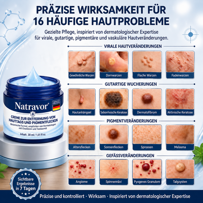 🇩🇪 Natravor® 🥑𝟕-𝐓𝐚𝐠𝐞 𝐇𝐚𝐮𝐭𝐚𝐧𝐡ä𝐧𝐠𝐬𝐞𝐥- & 𝐅𝐥𝐞𝐜𝐤𝐞𝐧-𝐄𝐧𝐭𝐟𝐞𝐫𝐧𝐮𝐧𝐠𝐬𝐜𝐫𝐞𝐦𝐞 (𝐒𝐜𝐡𝐦𝐞𝐫𝐳𝐟𝐫𝐞𝐢𝐞 𝐅𝐨𝐫𝐦𝐞𝐥 – 𝐨𝐡𝐧𝐞 𝐍𝐚𝐫𝐛𝐞𝐧)e