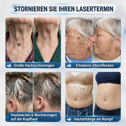 🇩🇪 Natravor® 🥑𝟕-𝐓𝐚𝐠𝐞 𝐇𝐚𝐮𝐭𝐚𝐧𝐡ä𝐧𝐠𝐬𝐞𝐥- & 𝐅𝐥𝐞𝐜𝐤𝐞𝐧-𝐄𝐧𝐭𝐟𝐞𝐫𝐧𝐮𝐧𝐠𝐬𝐜𝐫𝐞𝐦𝐞 (𝐒𝐜𝐡𝐦𝐞𝐫𝐳𝐟𝐫𝐞𝐢𝐞 𝐅𝐨𝐫𝐦𝐞𝐥 – 𝐨𝐡𝐧𝐞 𝐍𝐚𝐫𝐛𝐞𝐧)e